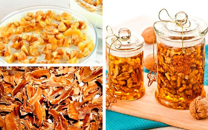 Receitas da xente